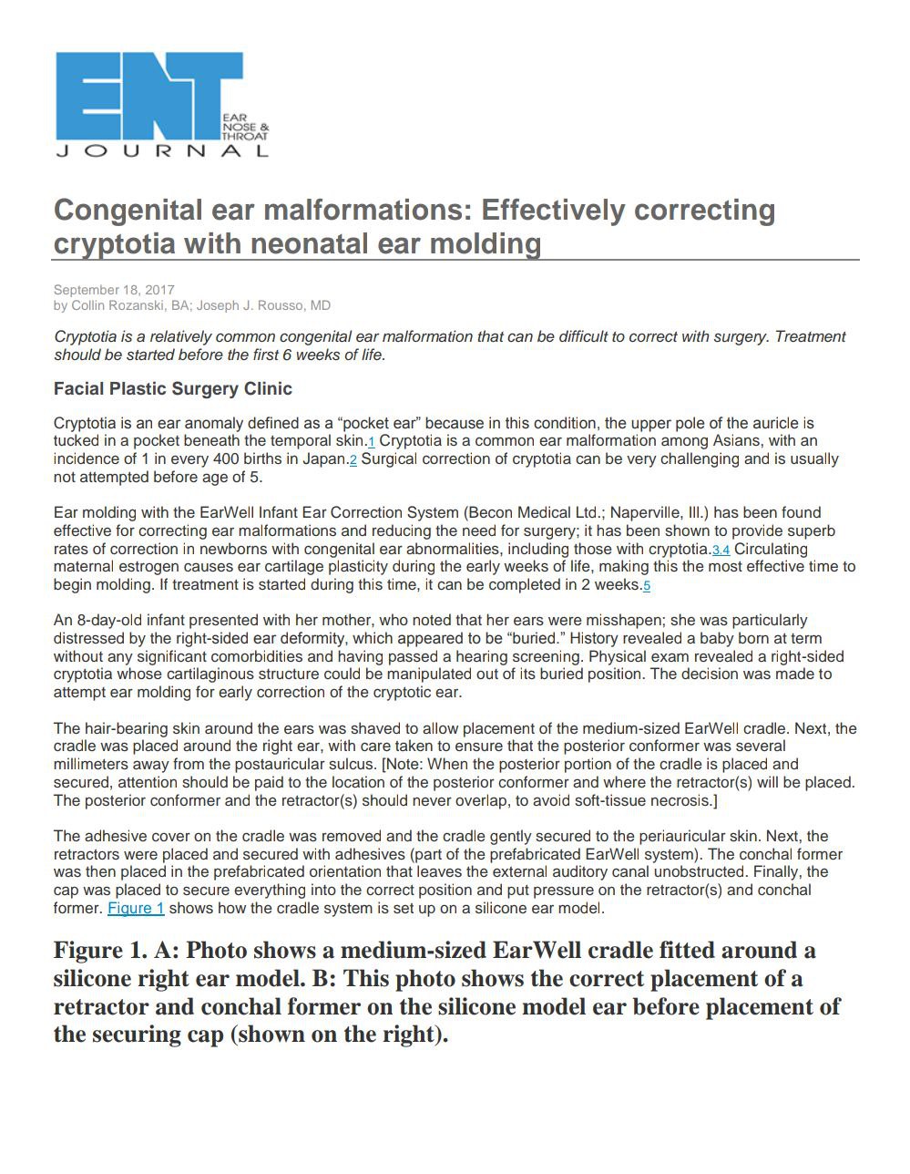Congenital ear malformations: Effectively correcting cryptotia with neonatal ear molding