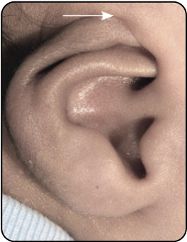 CRYPTOTIA