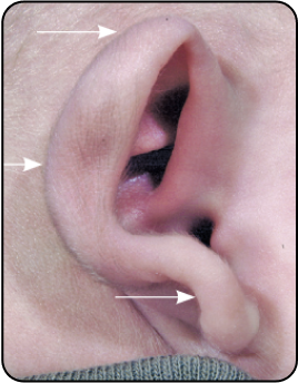 CUP EAR