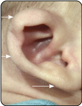 CUP EAR