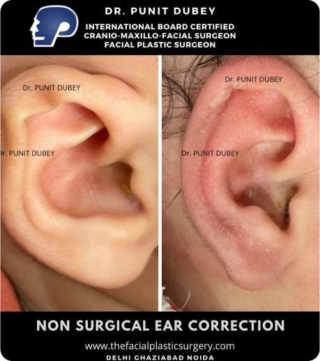 Earwell in India