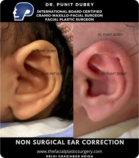 Earwell in India