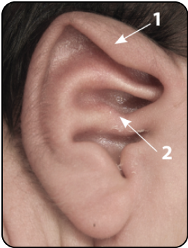 MIXED DEFORMITIES
