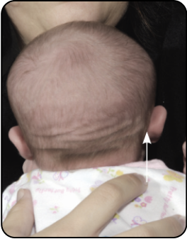 PROMINANT EAR